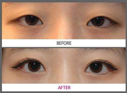 2023年晉中疤痕去除首選，彩光面部修復效果一覽無余！