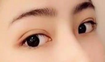 你是否了解面部提升除皺的基本原理和效果有哪些？