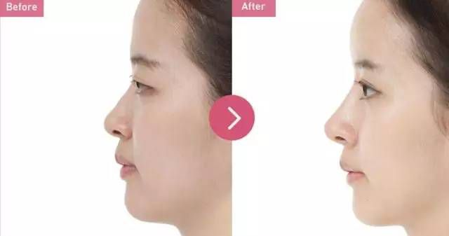 2023年天津太陽穴填充醫(yī)院排行榜出爐，這些醫(yī)院專業(yè)可靠！