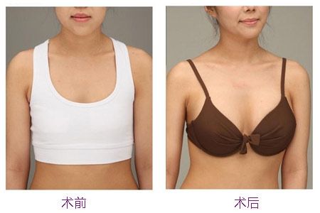 2023哪幾家四平面部精細(xì)雕刻整形醫(yī)院最具權(quán)威性？四平面部注射精細(xì)雕刻醫(yī)療專家推薦前十強(qiáng)！