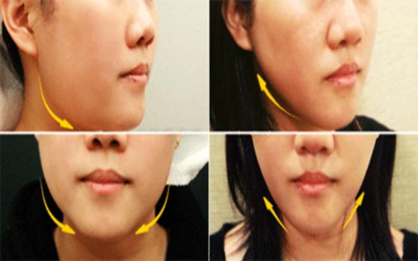 2023年臺州哪家面部吸脂整形醫(yī)院受到口碑好評？敬請參考推薦前十家正規(guī)醫(yī)院