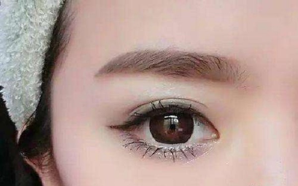 lisa容貌變化大是真的嗎？她進行了哪些面部改造？