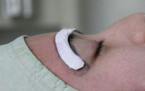 如何正確護(hù)理術(shù)后雙眼皮手術(shù)？