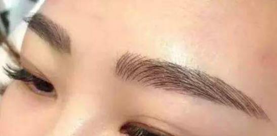 天使隆鼻幾天可消腫？恢復(fù)期及注意事項(xiàng)大公開(kāi)！