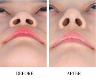 上海2023年比較好的自體脂肪注射眼睛細(xì)紋整形醫(yī)院排名TOP10，不容錯(cuò)過(guò)！