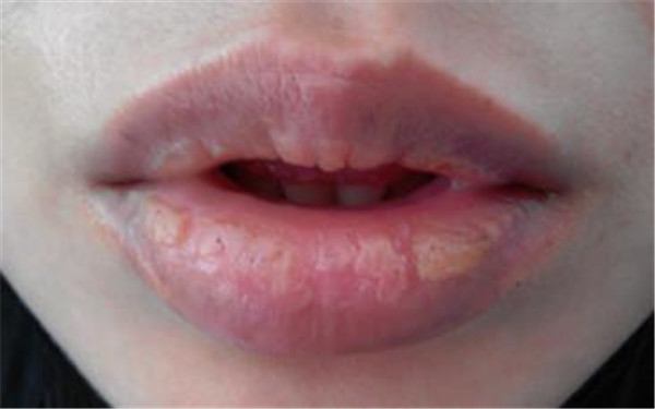 哈爾濱紫曦整形醫(yī)院的價格與口碑怎么樣？你有了解過嗎？