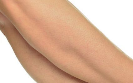 廣元雙眼皮正規(guī)醫(yī)院推薦排名及綜合評(píng)價(jià)TOP10