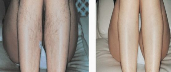 深圳有哪些治鼻子好的醫(yī)院？