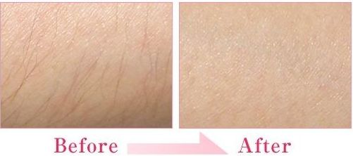 西安唇腭裂手術(shù)醫(yī)院排名及費用對比，哪家醫(yī)院好