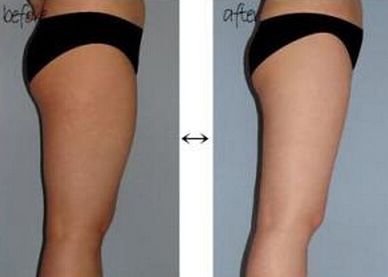 昆明做雙眼皮技術(shù)哪家好，最受用戶歡迎的昆明雙眼皮技術(shù)推薦有哪些？