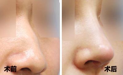 2023杭州中藥美白醫(yī)院排名出爐！十家口碑超好的整形醫(yī)院推薦