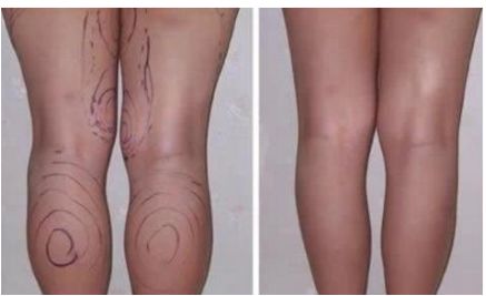 天津醫(yī)美醫(yī)院有哪些？了解這里為您整理的信息