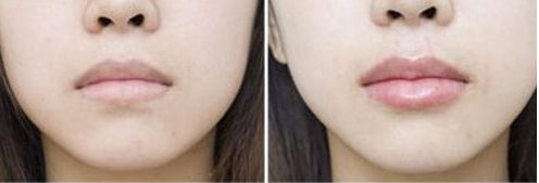 深圳唇缺損修復(fù)：排名前十的整形醫(yī)院盤點！