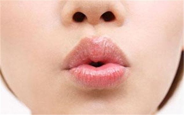 福州哪家醫(yī)院能夠進(jìn)行玻尿酸填充手術(shù)？玻尿酸填充手術(shù)需要選擇哪家醫(yī)院？