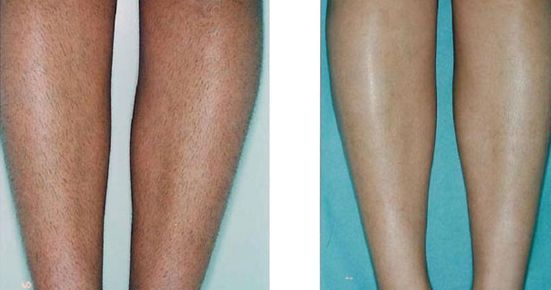 廣州鼻子整容哪家醫(yī)院口碑好，效果最佳？