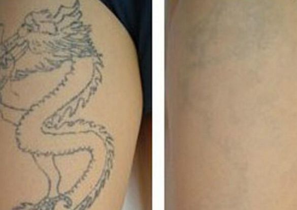 佛山面部吸脂醫(yī)院排名及評測，哪家最受用戶信賴？