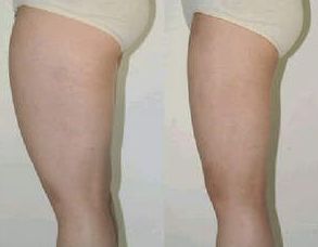 葫蘆島整形醫(yī)院排名如何？哪家好？