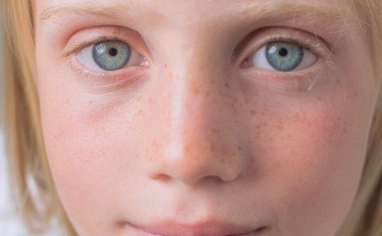 鄭州市哪家眼皮整形醫(yī)院口碑不錯(cuò)？讓你眼前一亮的推薦！