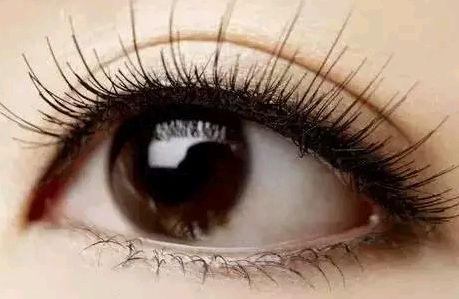 揭秘芙蓉姐姐的整容傳聞：舊貌換新顏！