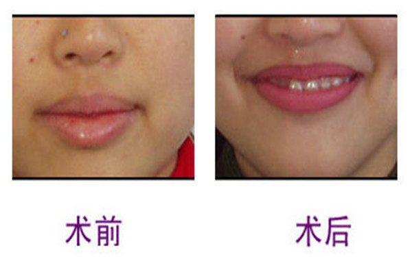 上海東方醫(yī)院是一家醫(yī)美整形的專業(yè)機(jī)構(gòu)嗎？他們的簡(jiǎn)介如何？