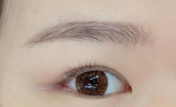 面部筋膜懸吊真的能讓人年輕嗎？或許會(huì)有哪些潛在風(fēng)險(xiǎn)呢？