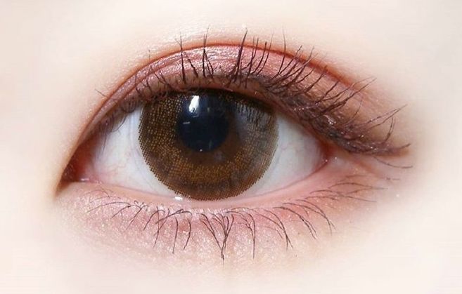 蘭州酒糟鼻癥狀如何，哪家醫(yī)院專業(yè)治療酒糟鼻效果好？