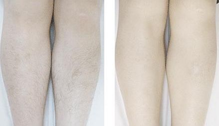 浙江哪家整形醫(yī)院可靠，不錯(cuò)的做隆胸效果好