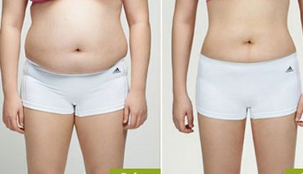 泰安假體豐胸醫(yī)院排名及費(fèi)用對(duì)比：哪家醫(yī)院做得好又劃算？