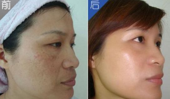 哪個(gè)常州醫(yī)院?？浦委煱毯坌Ч茫?></div>
                            <div   id=