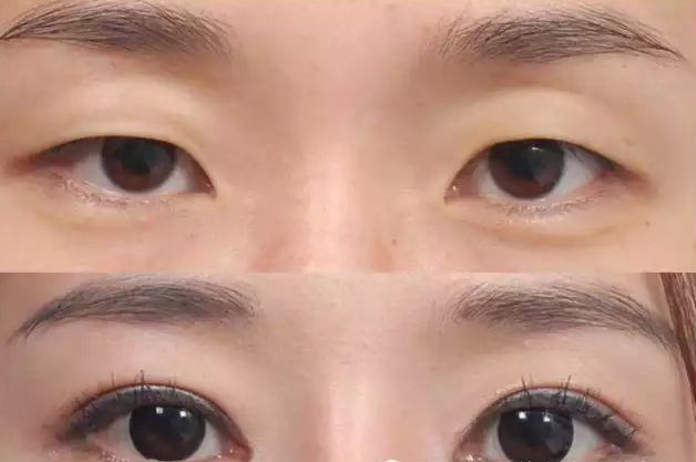 哪家醫(yī)院是唐山首選彩光點陣激光整形醫(yī)院2023唐山整形醫(yī)院行業(yè)迎來新變革！