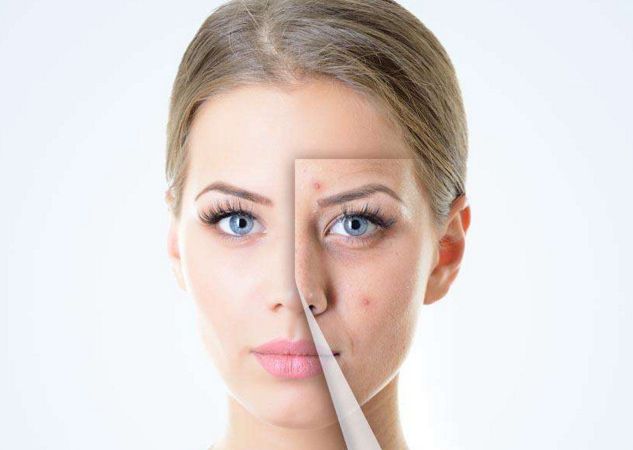 邯鄲哪家祛痘的效果好？比較邯鄲各大祛痘機(jī)構(gòu)的綜合實(shí)力和用戶口碑！