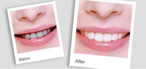 寧波權威溶脂醫(yī)院排行榜：重現(xiàn)完美身材