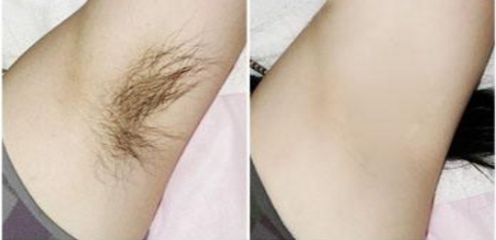 北京減肥好醫(yī)院排名推薦，哪家北京減肥的好醫(yī)院口碑最好