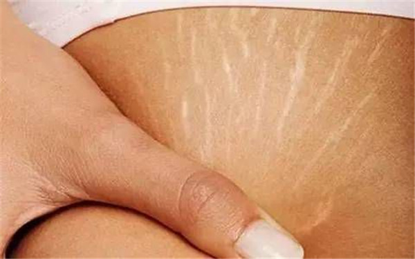 電波拉皮手術(shù)的價(jià)格如何？怎樣做電波拉皮手術(shù)前的準(zhǔn)備？電波拉皮手術(shù)前要考慮的事項(xiàng)有哪些呢？