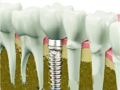 黑臉娃娃使用是否安全？使用前要注意的事項都有哪些？