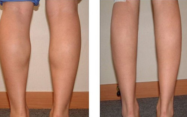 高曉松的健康秘訣是什么？他竟然在26天內(nèi)減去了26斤體重？