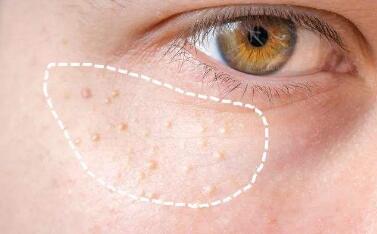 黑臉娃娃使用是否會(huì)有負(fù)面影響？經(jīng)驗(yàn)分享與功效解析談黑臉娃娃真相