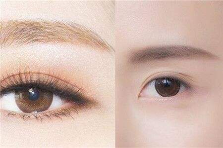 如何有效縮小鼻翼尺寸？讓你不再為寬鼻煩惱！