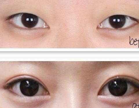 曙光醫(yī)院奪得桂冠，解密廣州的高級整容技術！