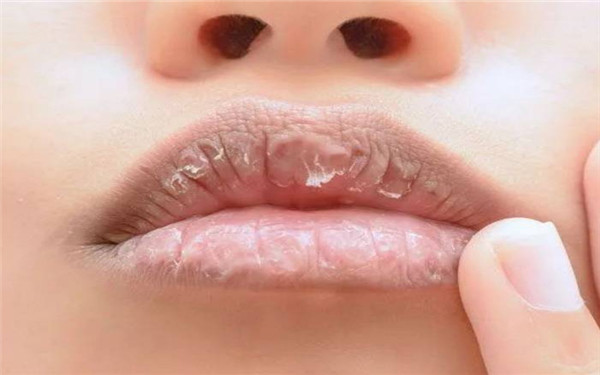 肇慶市第一人民醫(yī)院整形口碑好嗎？口碑真實(shí)可信嗎？