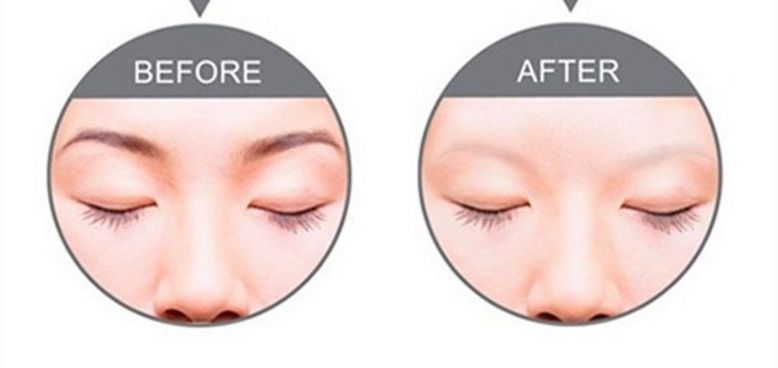 深圳正頜手術(shù)哪家醫(yī)院好？專業(yè)醫(yī)院推薦及患者評價