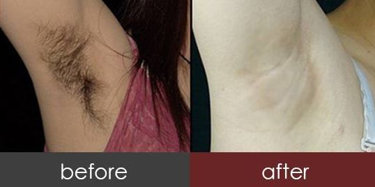 佳木斯去疤痕找專業(yè)醫(yī)院？推薦這幾家好口碑醫(yī)院給你！