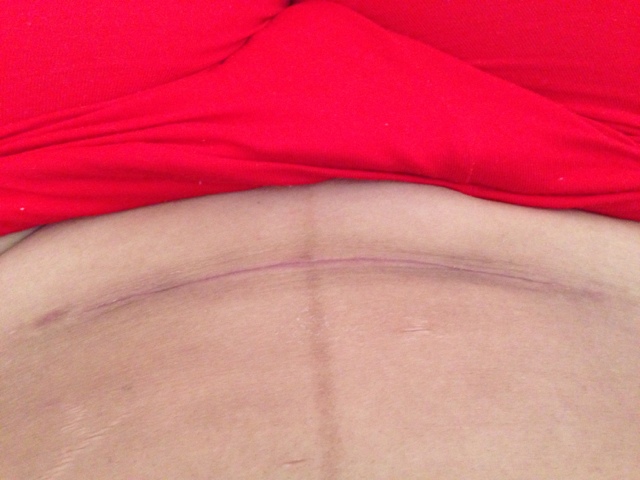 鄭大一附院整形美容科專家真的靠譜嗎？