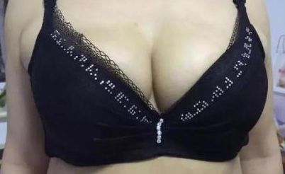 2023年濰坊地區(qū)雙眼皮整形醫(yī)院綜述