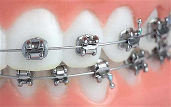 膠原蛋白隆鼻需要花費多少錢？收費標(biāo)準(zhǔn)和相關(guān)費用是怎樣的呢？別忘了了解這些隆鼻注意事項哦！