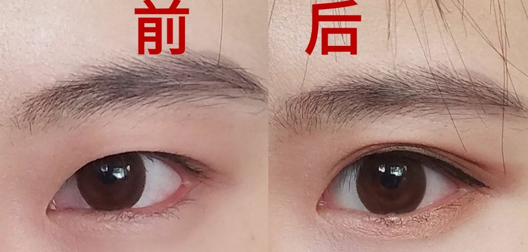 蘇州祛痘印醫(yī)院哪家好？專家推薦的頂級祛痘印醫(yī)療機構(gòu)有哪些？