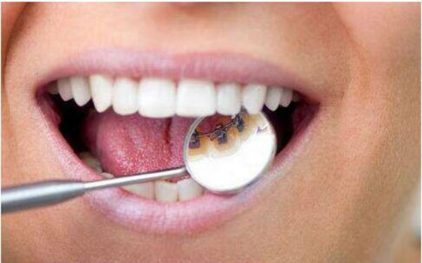 廣州哪些醫(yī)院治療法令紋效果好？2023年排名前10的醫(yī)院大比拼！