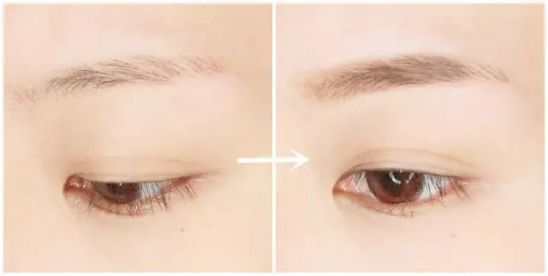 南京金陵醫(yī)院整形科2023吸脂價(jià)格表為什么如此吸引人？案例前后變化圖真實(shí)可信嗎？