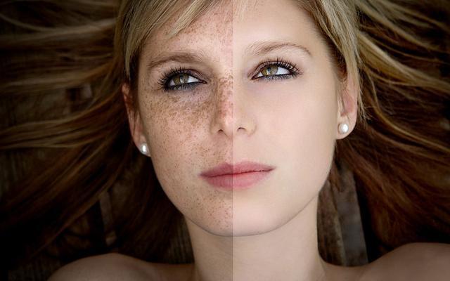 2023年哪家醫(yī)院在南通超聲刀去木偶紋整形排行榜前十名？網(wǎng)友眾說紛紜贊好！