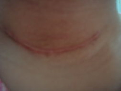 2023西安腿部減肥抽脂醫(yī)院技術(shù)排行榜：探尋西安哪家整形醫(yī)院將成為您健康美腿的選擇